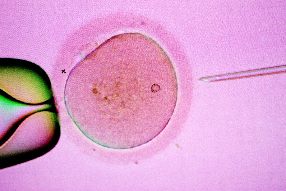 IVF-BEHANDLING